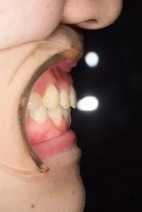 症例2　