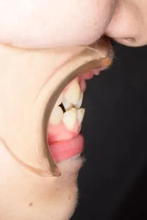 症例2　