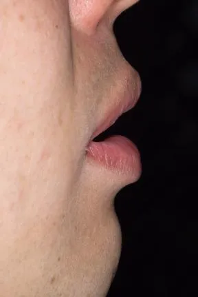 症例3　