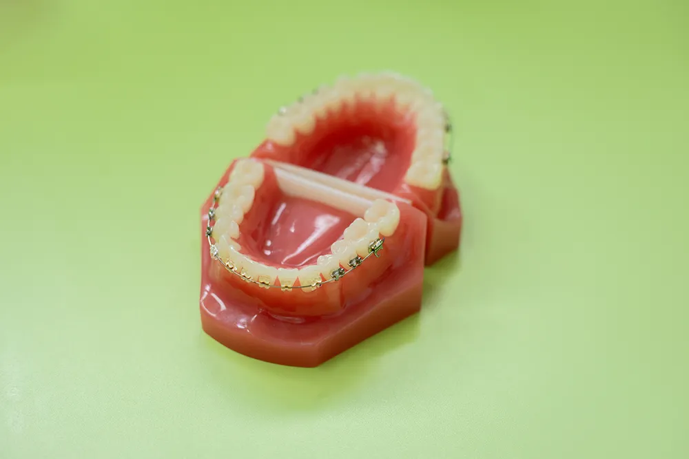 ラビアル(表側矯正)